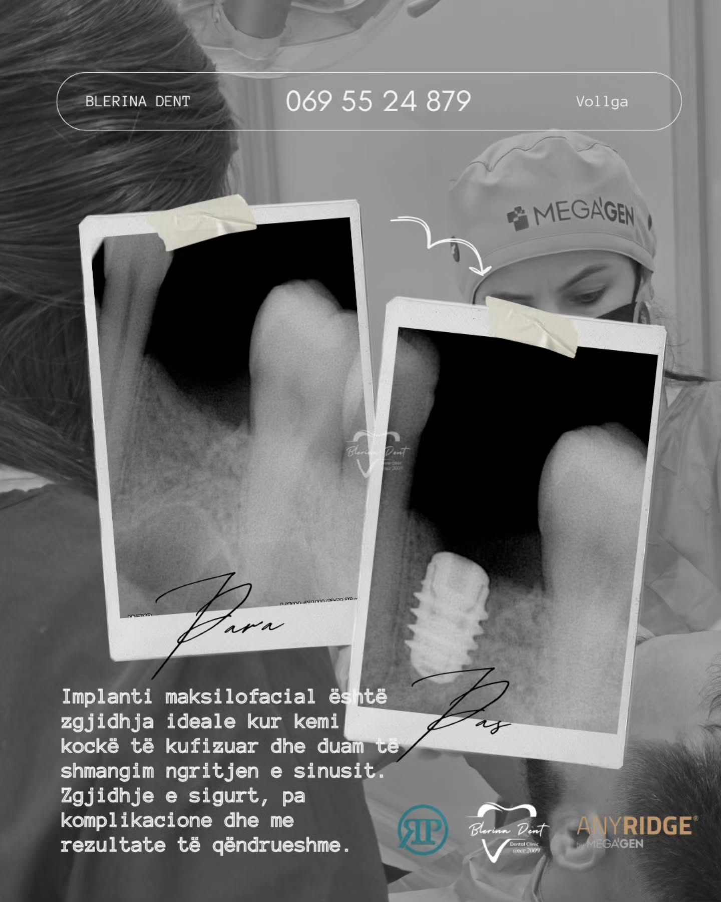 Person with dental implants shown in black and white images, with text overlay.