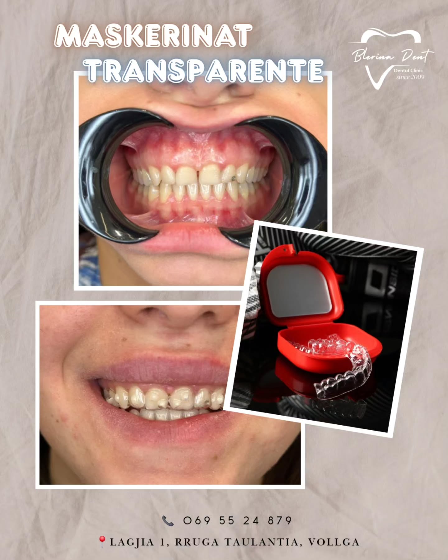 Mascherine trasparenti: comodità e funzionalità in un prodotto moderno