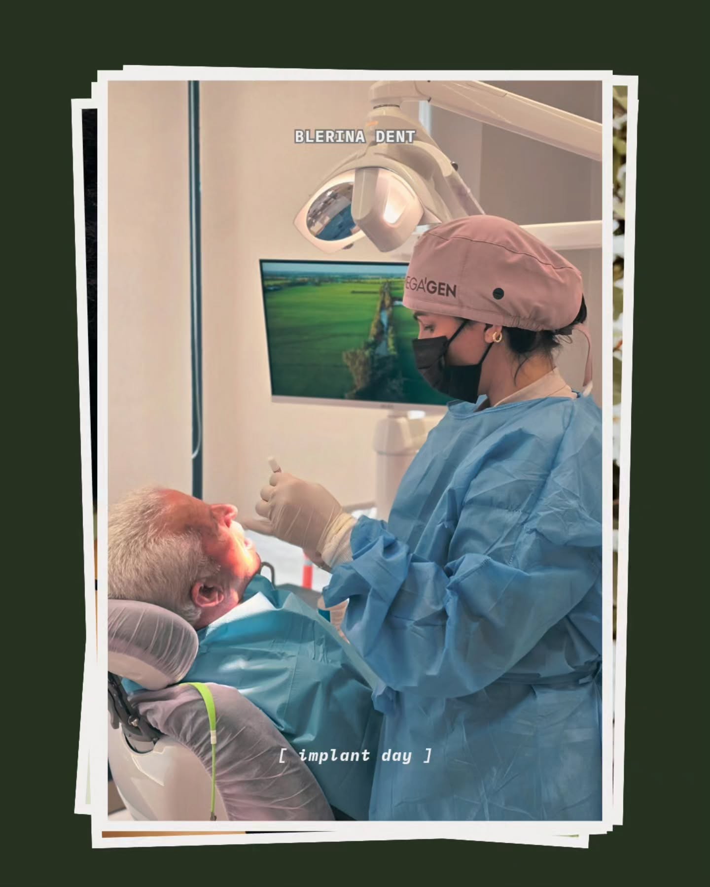 Implanti Dentali