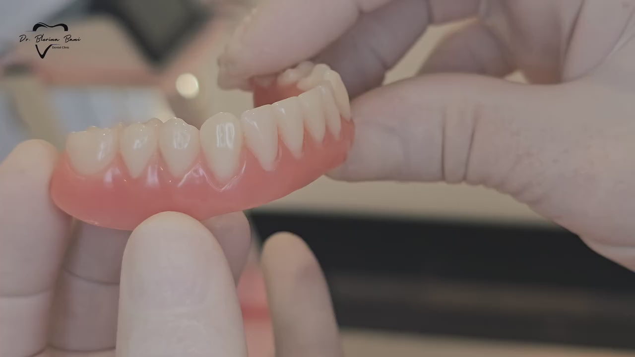 Implanti Dentali